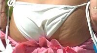 Celulitis de Britney Spears