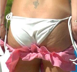 Celulitis de Britney Spears