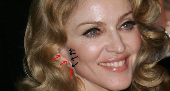 Madonna: su lifting detectado en el pliegue de su oreja