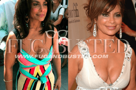 Paula Abdul tiene pectus excavatum