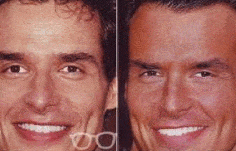 Operaciones estéticas de famosos