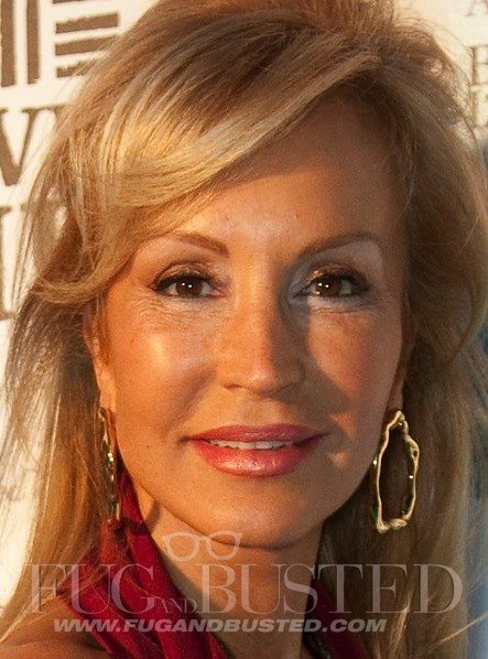 ¡BOMBAZO! Carmen Lomana tiene 70 años » carmen lomana lifting Carmen Lomana - Lifting