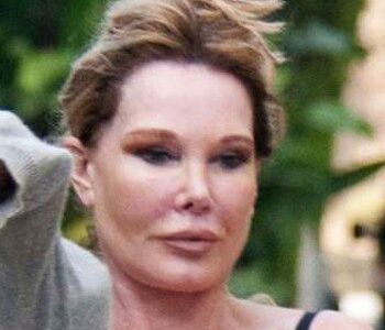 Jocelyn Wildenstein