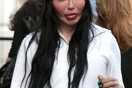 Pete Burns - Cirujía plástica