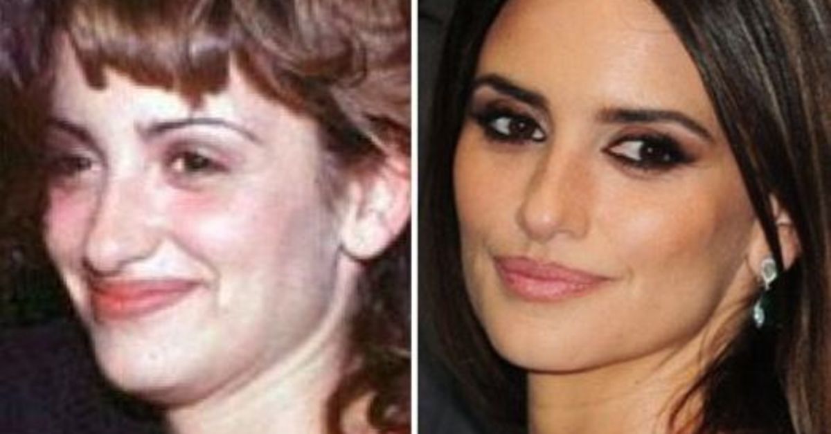 Penélope Cruz antes de operarse